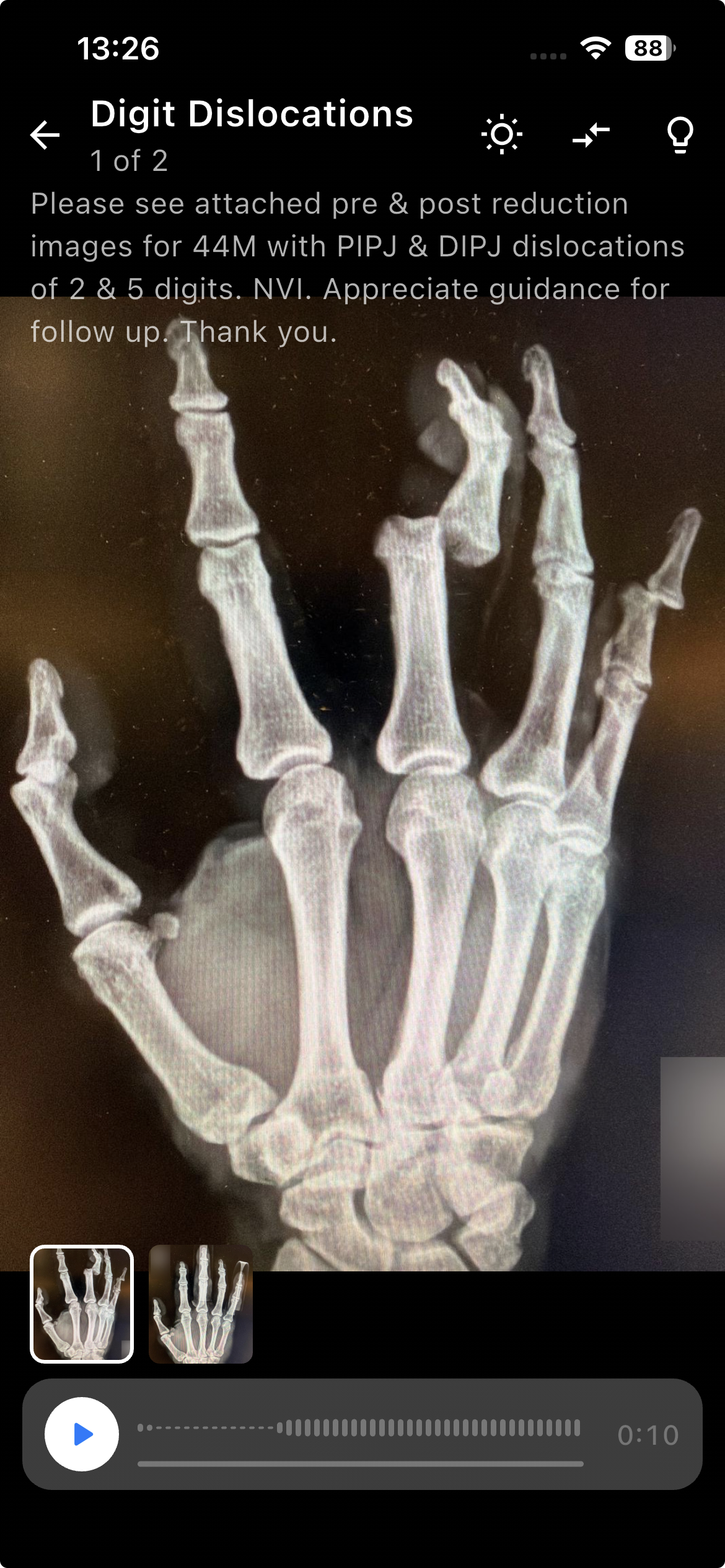 EMMS clinical case detail view