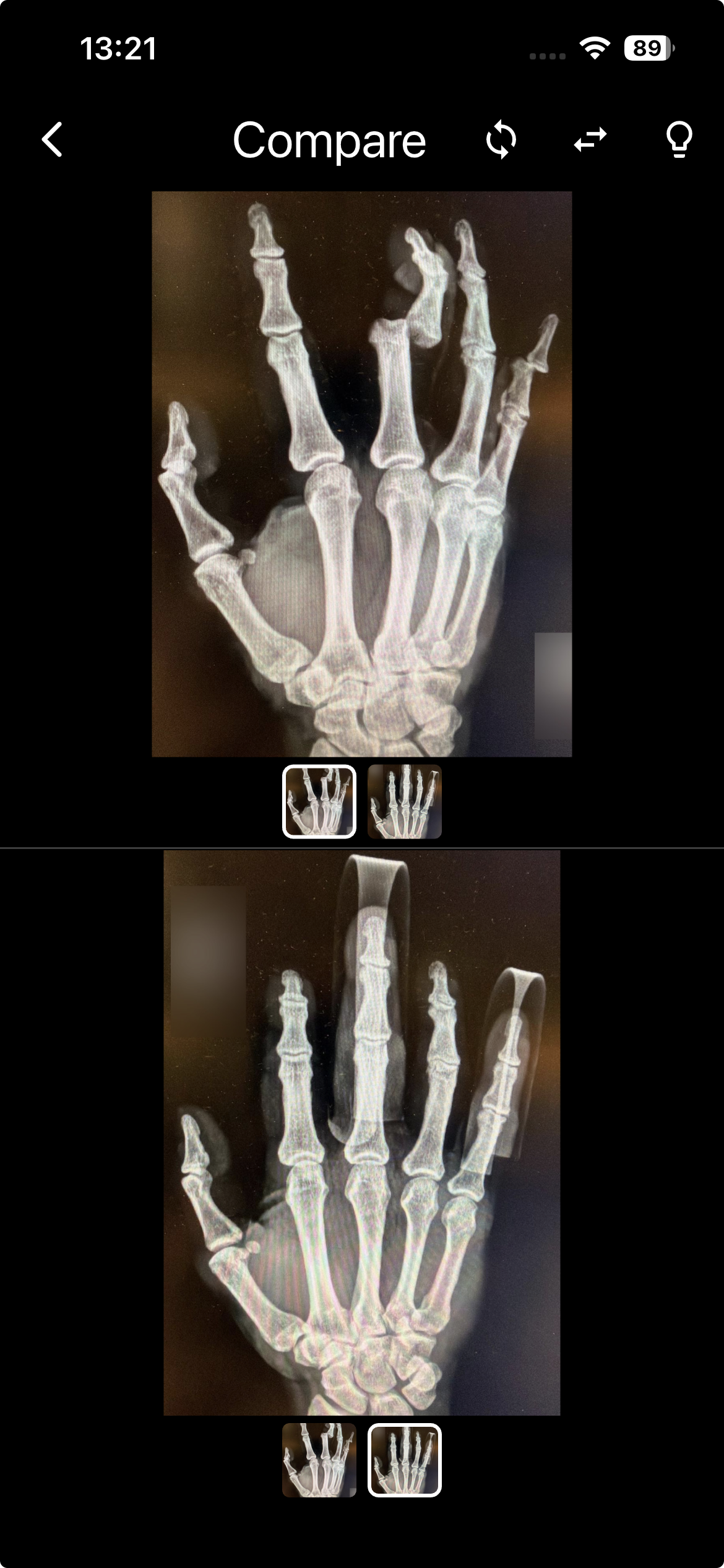 EMMS clinical case compare mode
